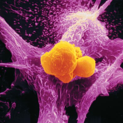 Макрофаг атакует раковую клетку
