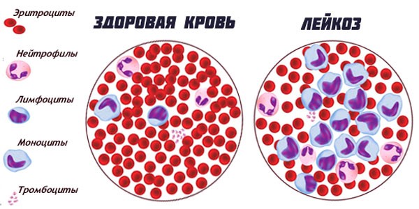 Рисунок с сайта https://oncology24.ru