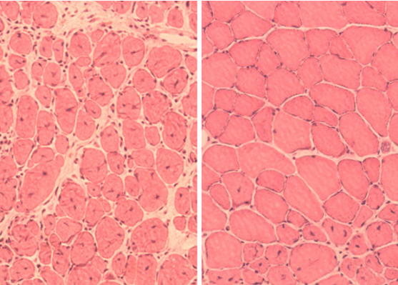 Рисунок 3 – Восстановление мышечной ткани у мышей без (слева) репрограммирования клеток и с ним (справа) [15]