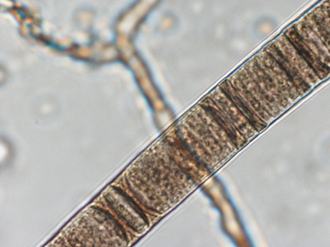 Oscillatoria sp. (х1000)