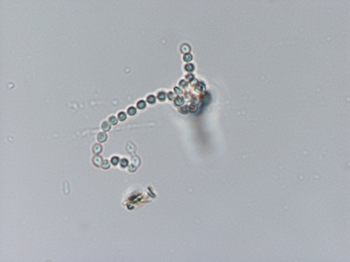 Anabaena sp. (х1000)