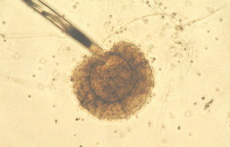 Плесневый гриб Aspergillus tubingensis